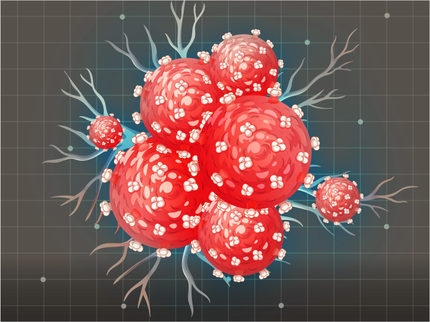 Diagnostics-IND-SPgs-Cancer