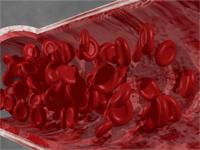 Diagnostics-IND-SPgs-Anemia