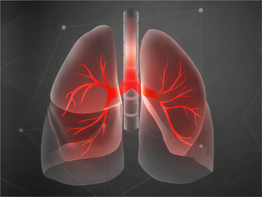 Diagnostics-IND-SPgs-Lungs