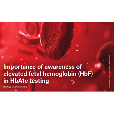Diagnostics - US - high Hb F article 2