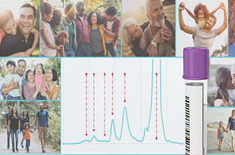 Diagnostic - US - World diabetes4